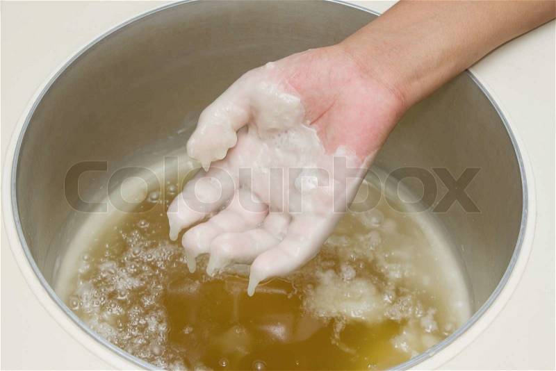 Physical therapy treatment and beauty,Hand in paraffin bath ,Patient receiving heat therapy on hands, stock photo