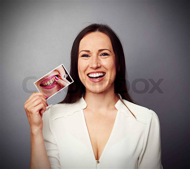 Healthy happy woman holding picture with dirty yellow teeth, stock photo