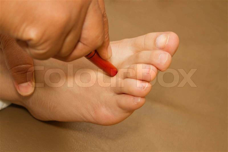 Reflexology foot massage, thai spa foot treatment by wood stick, stock photo