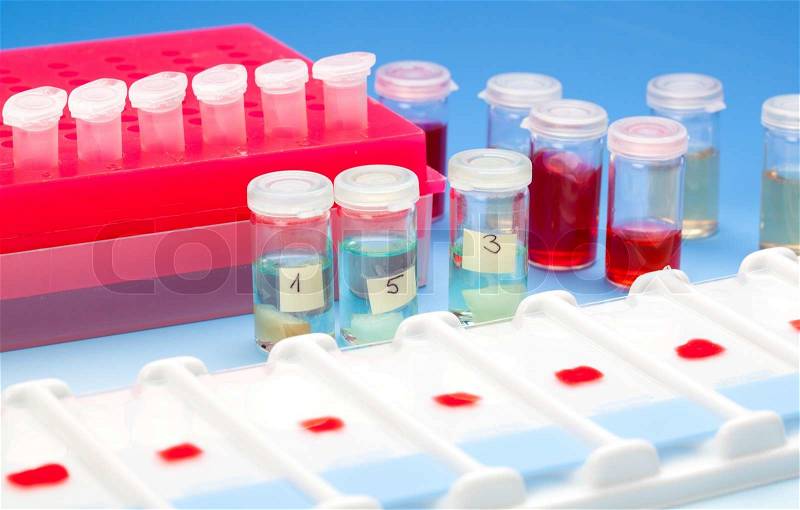 Array of blood samples for microscopy and biopsy tissue on blue gradient background, stock photo