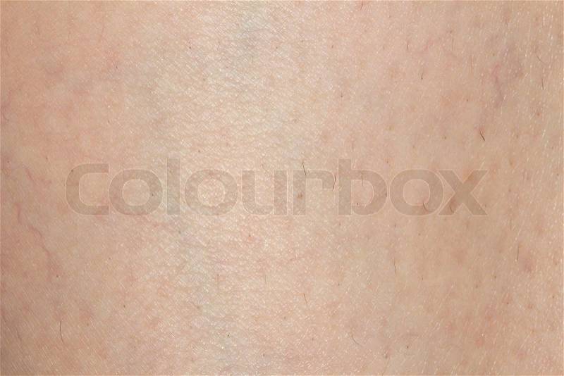 Background of the skin with hair. macro, stock photo