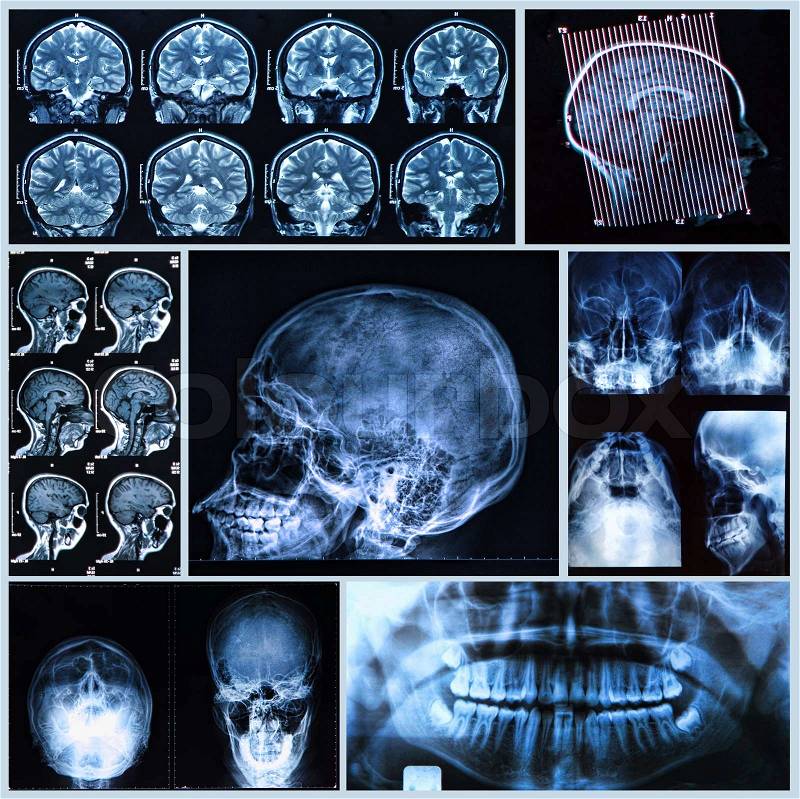 X-ray, tomography and MRI scans of the Human head, stock photo