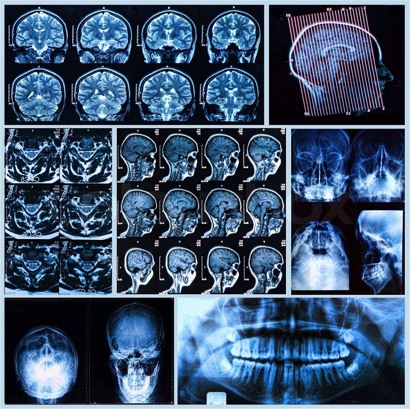 X-ray, tomography and MRI scans of the Human head, stock photo